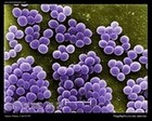 Staphylococcus aureus SEM micrograph